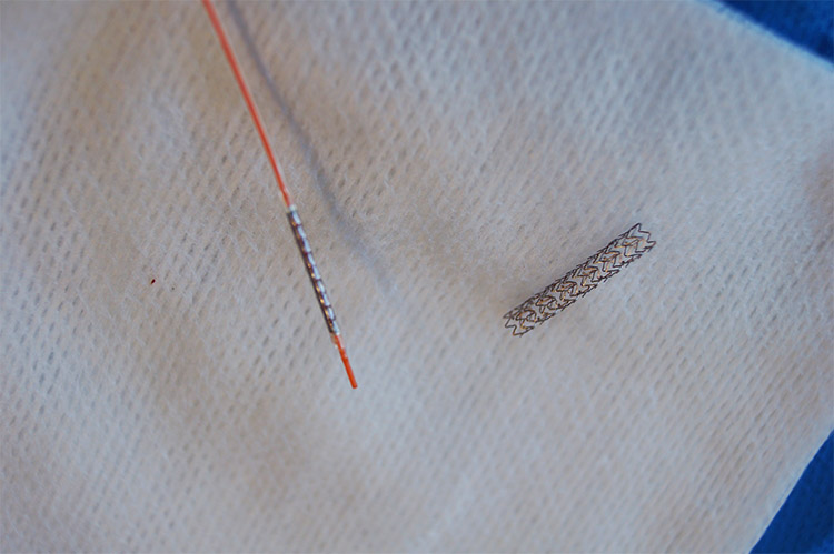 Les stents coronaires