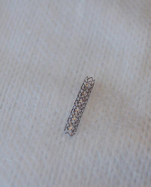 stent coronaire deploye